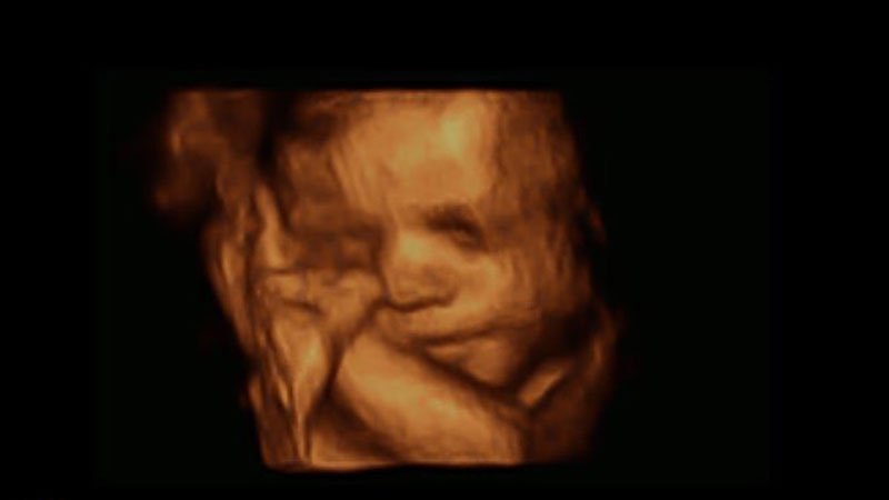 High-definition Ultrasound | Gundersen Health System