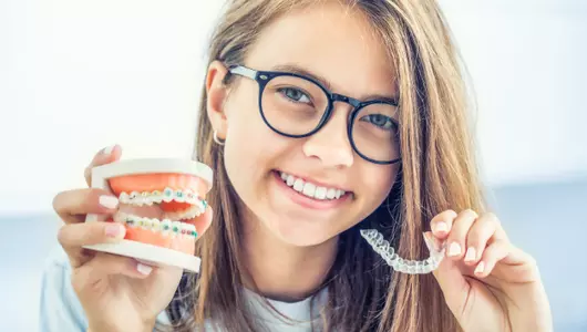 Girl with orthodontic braces and clear aligners